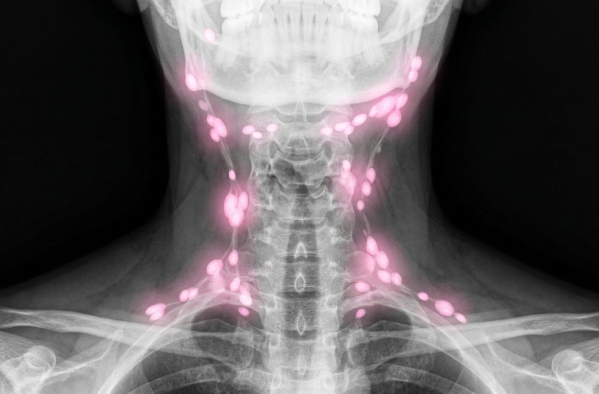 УЗИ лимфоузлов детям в Хабаровске — Практика и Культура